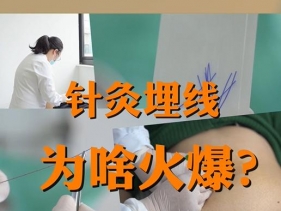 针灸埋线就能瘦？